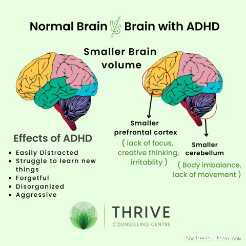 At What Age Is the Brain Fully Developed with ADHD? Find Out Here