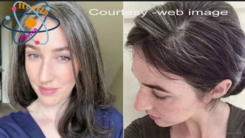Can Grey Hair Darken Again? The Truth Behind Graying Hair
