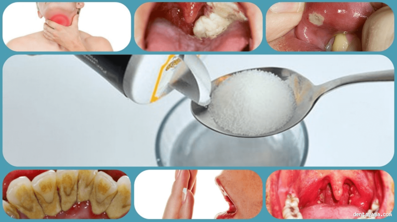 Can Salt Water Help Tooth Infection? Here's the Real Deal