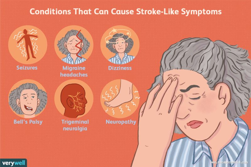 Can You Tell if You've Ever Had a Mini Stroke? Here’s What You Need to Know
