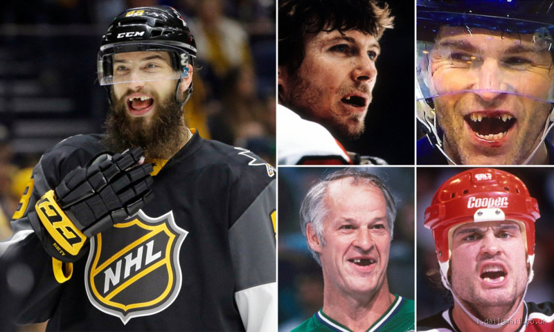 Do Hockey Players Really Lose Teeth? The Brutal Truth Revealed