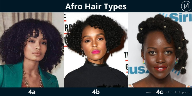 Do Africans Have Dry Hair? The Truth You Need to Know