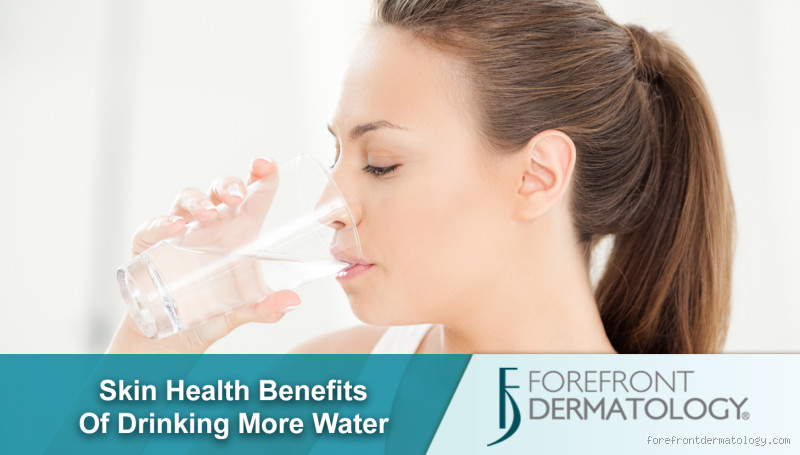 Does Drinking Water Help Acne Scars: Hydration and Skin Health Benefits