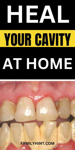 How Can I Rebuild My Teeth and Gums Naturally? A Step-by-Step Guide