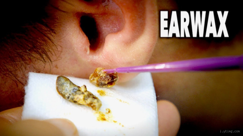 How Do You Break Up Deep Ear Wax? Easy Steps to Clear Your Ears