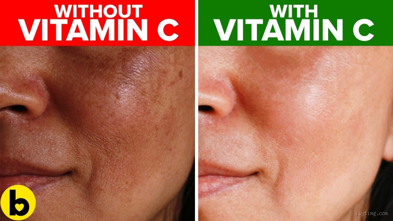 How Long Should I Leave Vitamin C on My Face? The Truth Revealed
