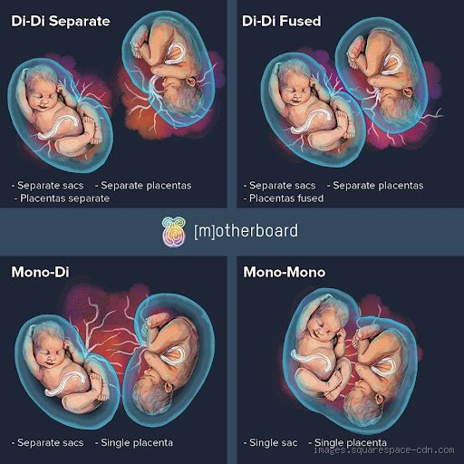 How Many Weeks Do Twins Appear? The Ultimate Guide for Expecting Parents
