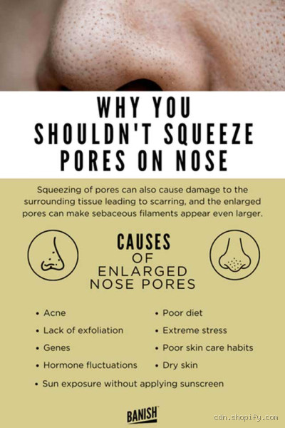 Is Squeezing Your Nose Pores Bad? The Truth You Need to Know