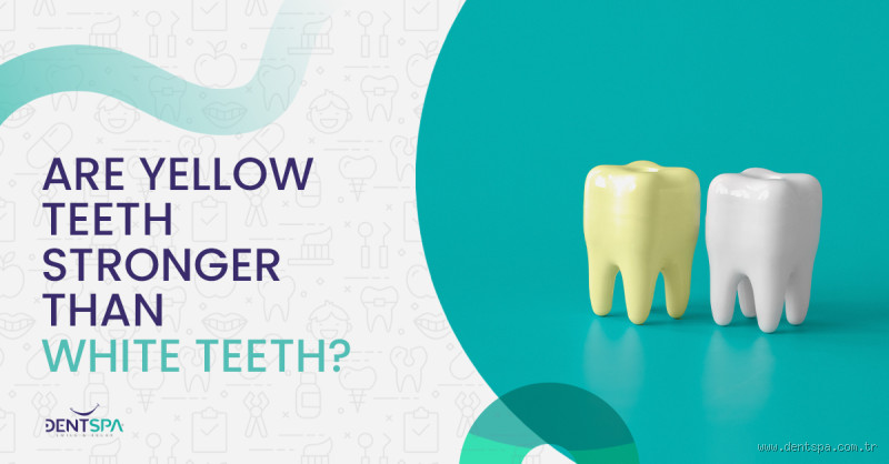 Are Yellow Teeth Stronger Than White Teeth? Let’s Find Out!