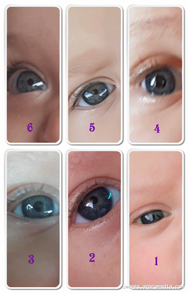 Discover Your Baby's True Eye Color: When Will It Settle?