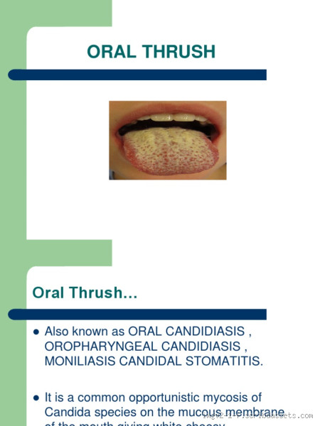 What Are the Red Flags for Oral Thrush? Key Signs to Look For