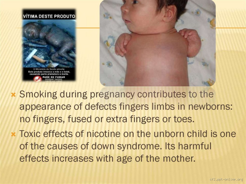 What Birth Defects Are Caused by Smoking? Understand the Risks
