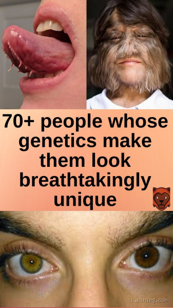 What Determines Your Looks: Is It Just Genetics or Something More?