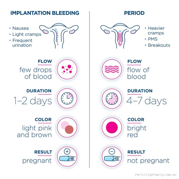 What does early implantation discharge look like? A subtle sign with big meaning
