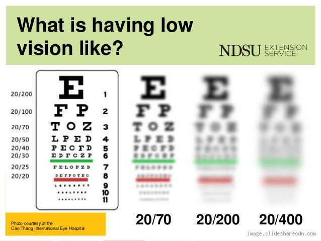 What is 40 Percent Low Vision? Understanding the Impact