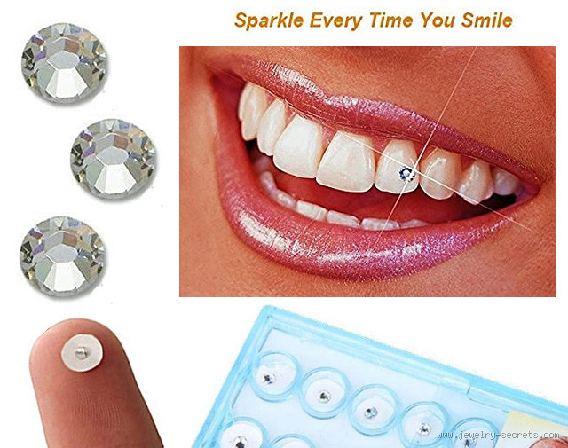 What Is Diamond Teeth? Bling, Status, and Real Talk