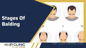 What is the Evolutionary Advantage of Balding?