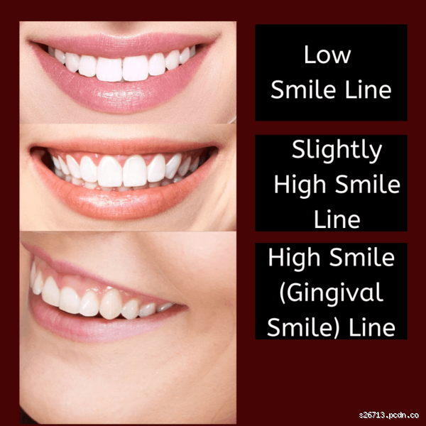 What is the Rule of 40 in New York? Everything You Need to Know