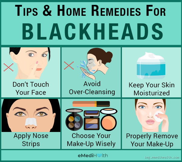 What Not to Use for Blackheads: Avoid These Skin Care Mistakes