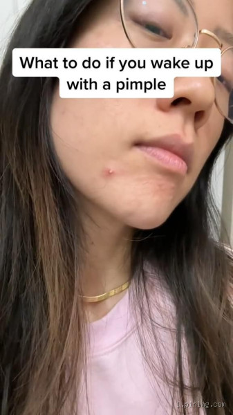 What to Do When You Wake Up with a Big Pimple? Your Ultimate Guide