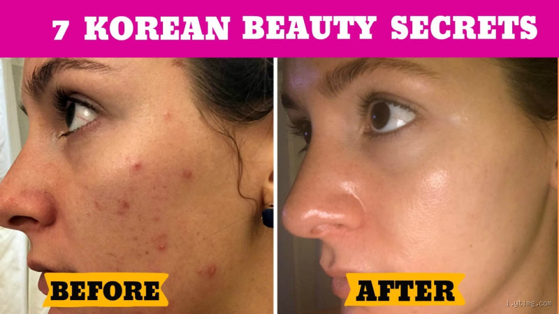 Why Do Korean People Have Amazing Skin? Discover Their Secrets