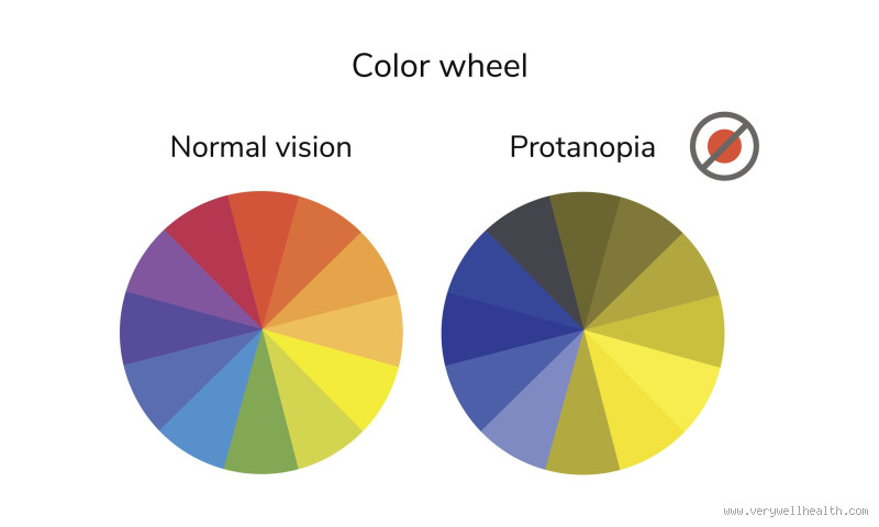 Can Some People Only See Blue: Understanding Rare Color Vision Conditions?