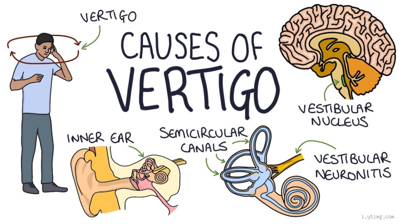 Does shaking your head help vertigo? The surprising truth