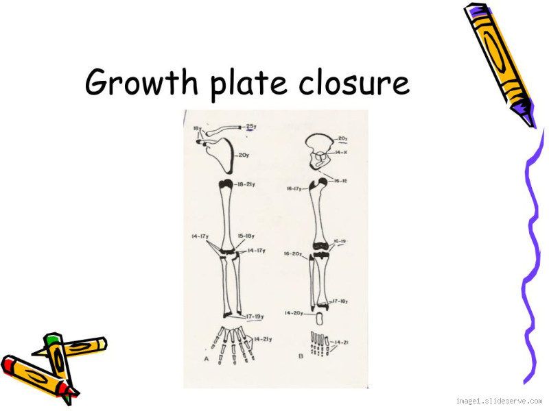 What Age Do Growth Plates Close? Understanding This Key Developmental Milestone