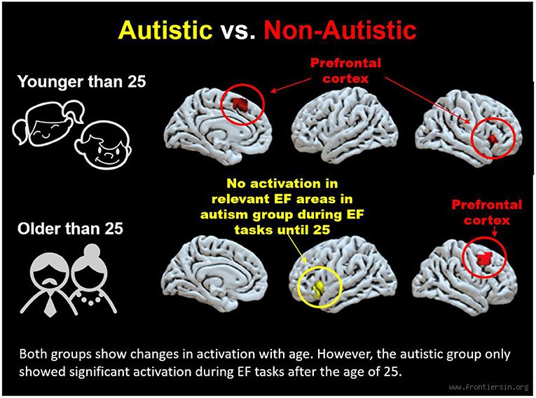 What Age Does the Brain Develop in Autism?