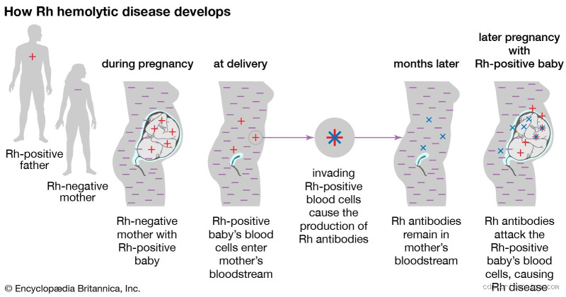 Where Did Rh Blood Type Come From? Uncovering Its Origins